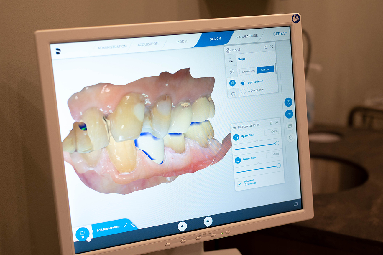 Digital Dentistry | West Wind Dental