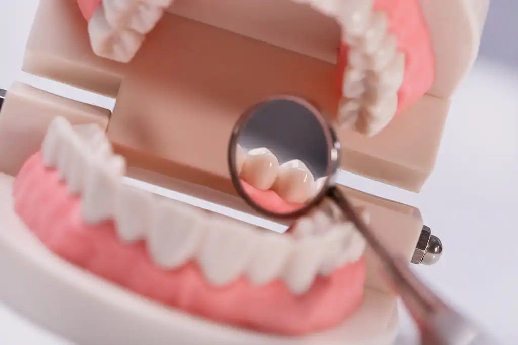 A dental mold being examined by a small dental mirror tool for examination.